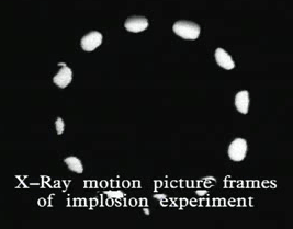 xray gif