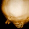 Unidentified<